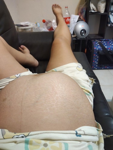 อยากรู้ค่ะว่าแบบคือปกติมั้ย