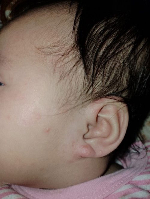 Butlig2x na may dalang tubig