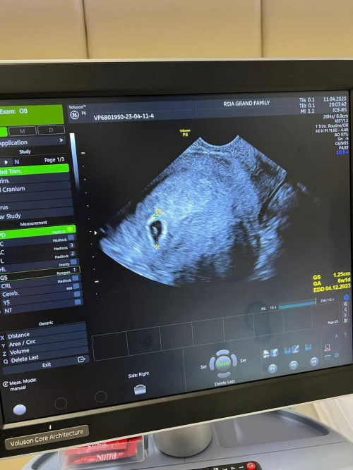 HPHT 3 Maret, 6week 😍