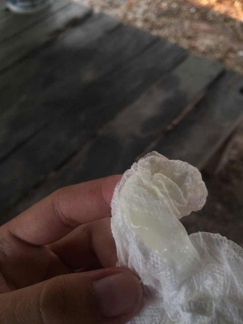 มีแบบนี้ออกมาคืออ่ะไรค่ะแม่ๆ🥺🙏🏻