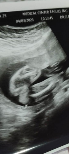 Baby gender