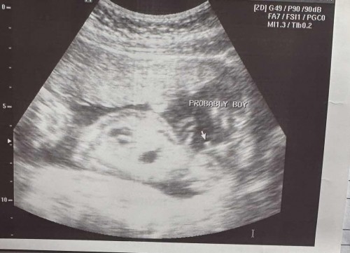 Gender ni baby
