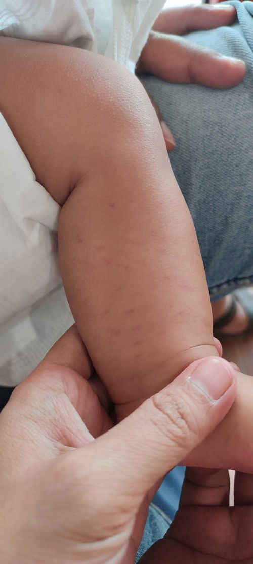 Kaki bayi 2 bulan bintik bintik