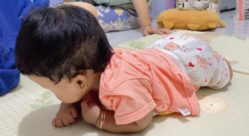 Biang keringat di bayi 5 bulan