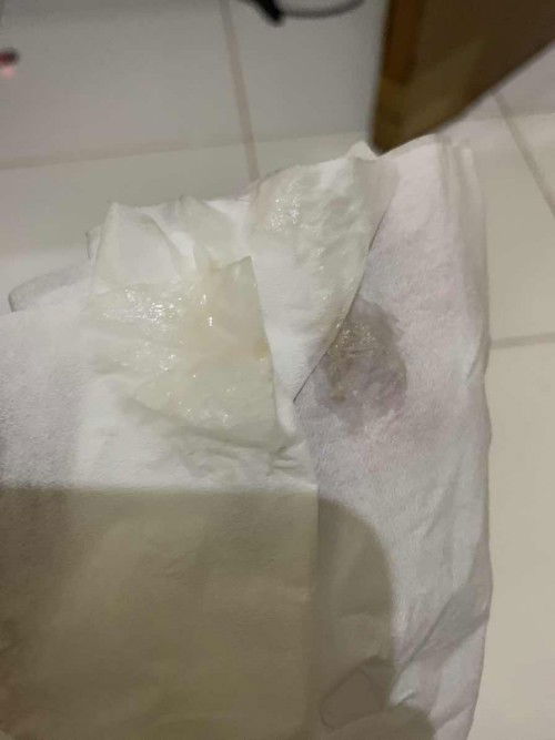 Flek coklat, positif hamil, belum telat haid, perut mules, puasa