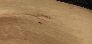 ไหมละลายกี่วันจะละลายหมดคะ