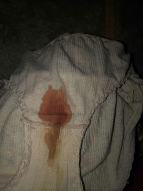 Alhamdulillah muncul Flek darah