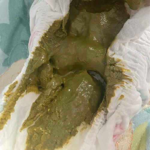 NAJIS WARNA HIJAU NORMAL
KE