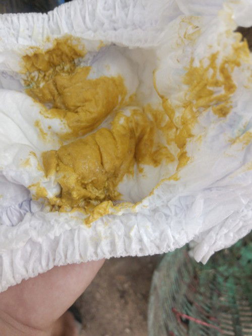 น้อง3เดือน18วัน ก่อนหน้านี้ถ่ายแข็งเป็นก้อน พึ่งเปลี่ยนนมปกติมั้ยคะ ถ่าย3รอบแล้วค่ะ