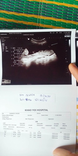 ขอถามแม่ๆหน่อยค่ะวันนี้ซาวด์ท้องมาตอนนี้อายุครรภ์20+1แล้วค่ะ