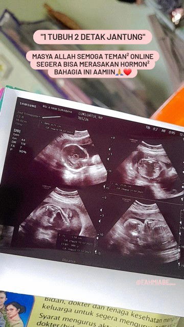 Posisi Janin Tngkurap,Bun mau tau dong bantu sharing apa masih bisa lahiran normal 26w4d