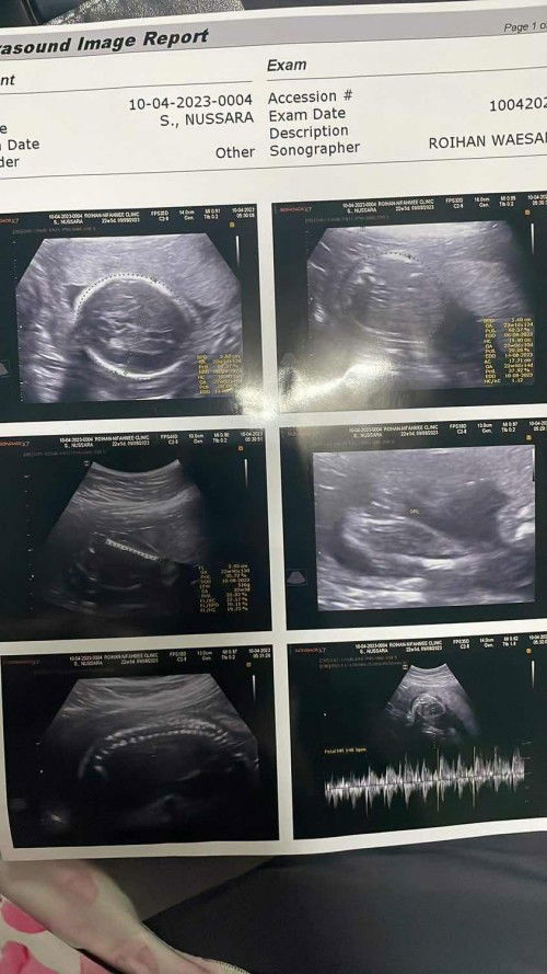 ขอสอบถามหน่อยค่ะ