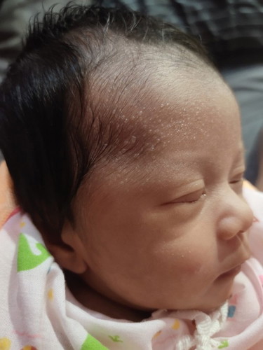 แบบนี้ น้องเป็นอะไรค่ะ ต้องไปหาหมอมั้ย