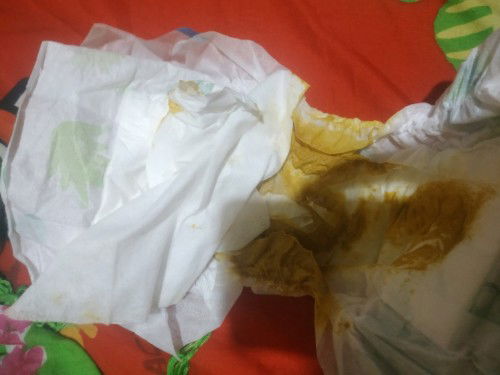 Fases bayi 3 minggu maaf jorok bund