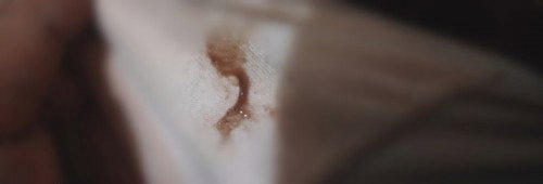 Vaginal Discharge