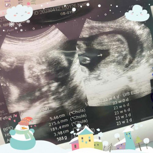 กว่าจะได้รู้เพศ😂