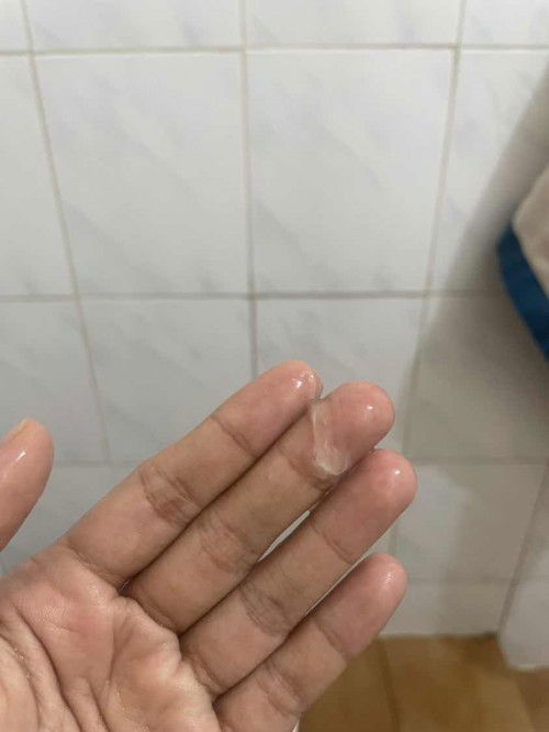 ใกล้คลอดยังคะ อยากแตกไม่ไหวแล้ว