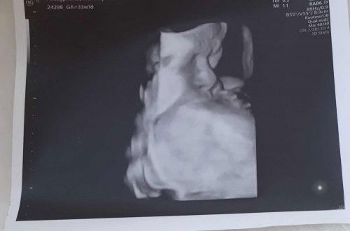 4เชื้อสาย มีแต่คนบอกจมูกหนูเหมือนแม่เลย🥰