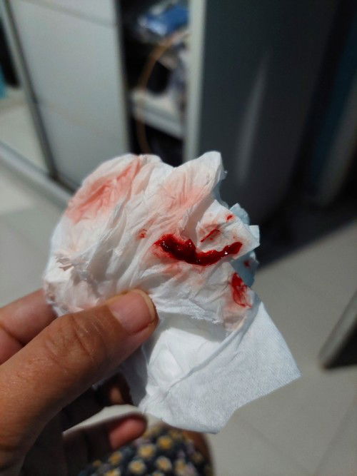 38 week keluar lendir darah tapi tidak mules dan kontraksi