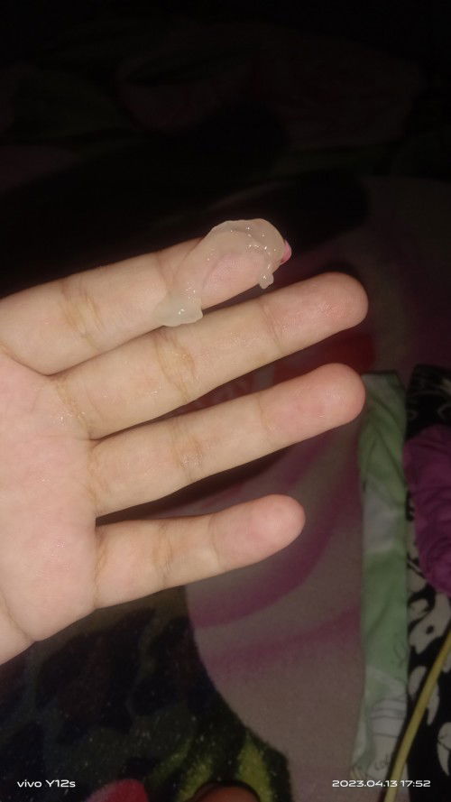 Keluar lendir atau keputihan