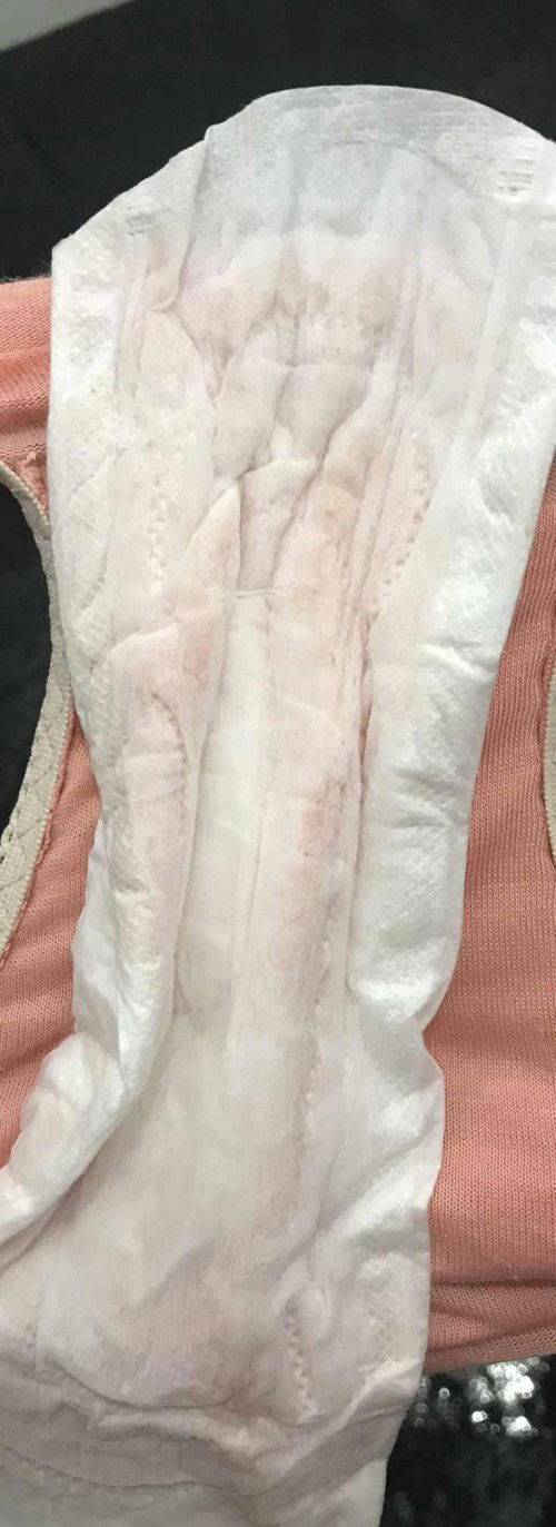 Sudah 2 hari keluar cairan kaya gini tp ga mules