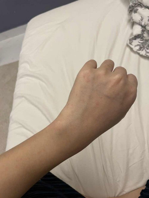 Naik bintik merah mcm ruam tapi tak gatal.