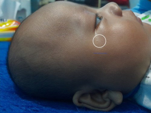 Bintik kecil ada putih putih didalemnya