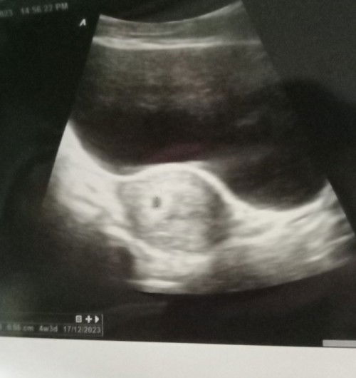 Bun, aku baru telat haid 2 hari, ditestpack sudah positif.. Sudah cek juga..