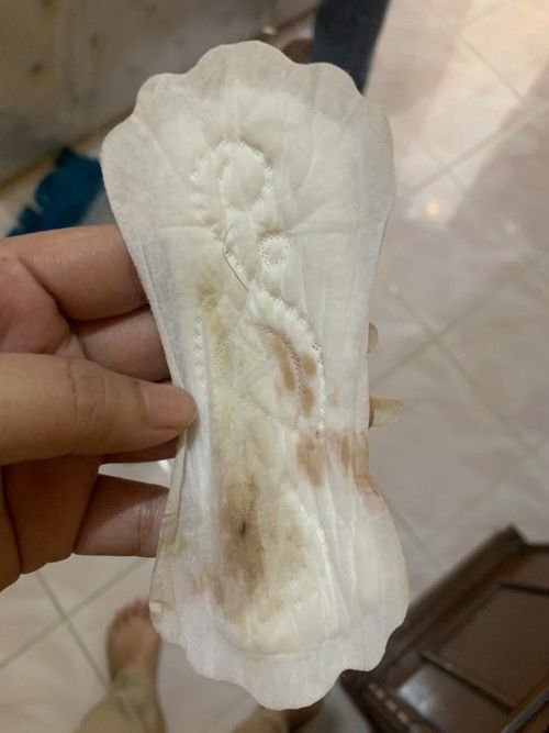 Keluar darah saat hamil 5 minggu