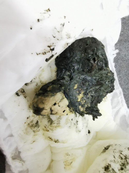 ลูก 1.3ขวบ อึสีเขียวเข้มปนเหลืองอ่อนซีด ปกติไหม เกิดเพราะอะไร