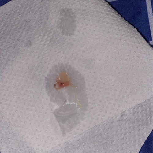 dari pembukaan dua ke lahiran berapa hari ya bund say?