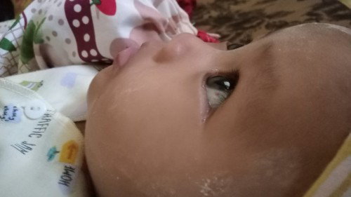 Bintik merah pada putih mata