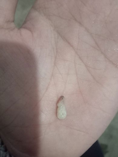 Keputihan ada bercak darah