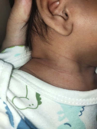 Ano po yung nasa leeg ni baby