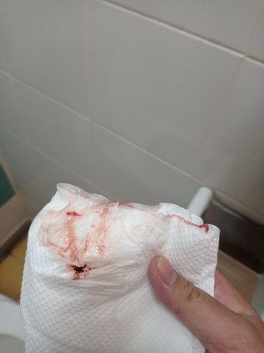 Cek bukaan