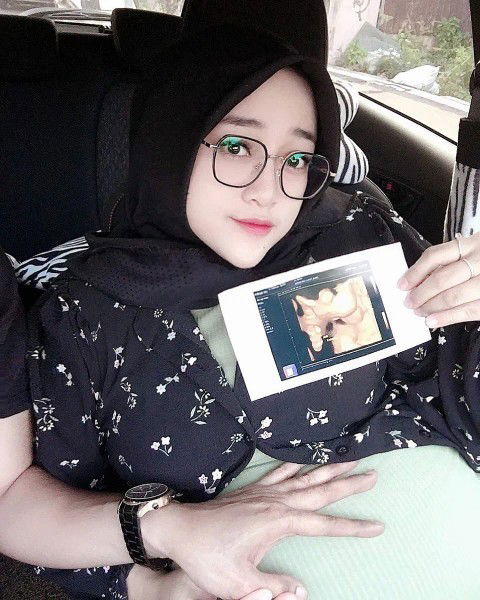 33 minggu tentang plasenta menutup jalan lahir