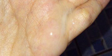 Usia kehamilan 36 minggu keluar ky keputihan