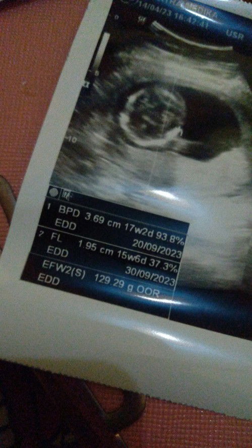 bun maaf tanya, soalnya td nggak sempet tanya dokter.