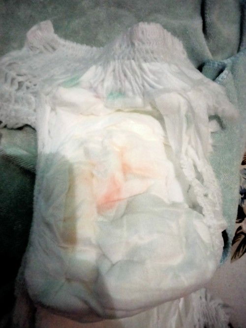 Bayi 2 bulan 5hari Urine berwarna merah muda