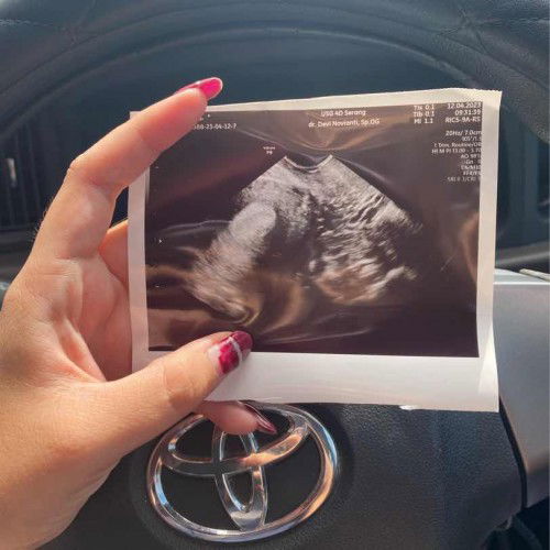 5week2d tp kata bidan masih di bawah 4week