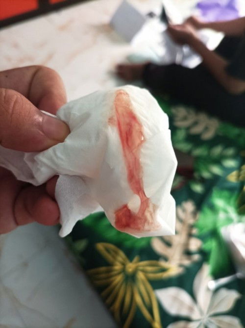 Keluar flek dan lendir darah