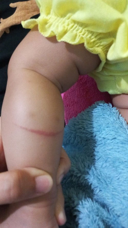 Solusi obat /salep luka bayi