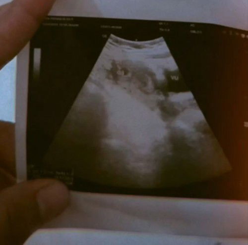 HPHT 6 Februari 2023