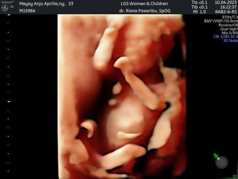 Tempat USG di Tangerang