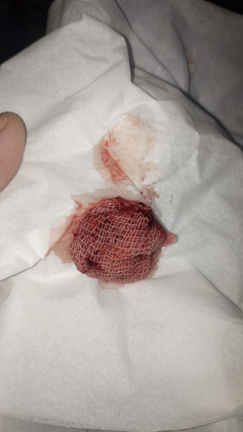 Kain kasa ketinggalan