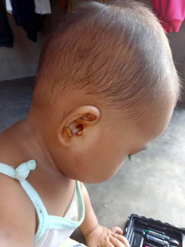 May ubo at sipon Yung baby ko nagka lagnat din Po sya 13