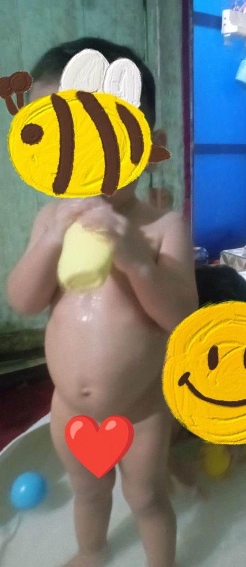 Wajar gak Bun kalau perut kembung nya kayak gini? Tips apa yah? (Anak umur 15 bulan)