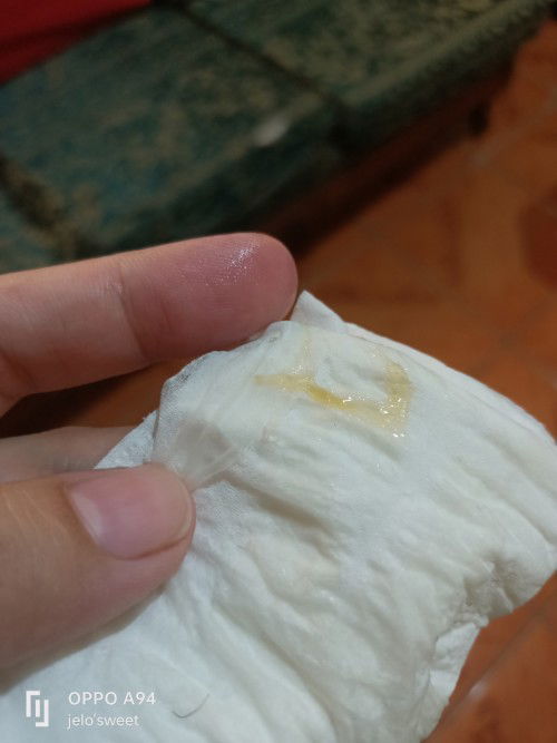 Transparent yellow discharge
18weeks 4 days pregnant