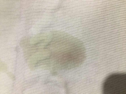 Need advice po