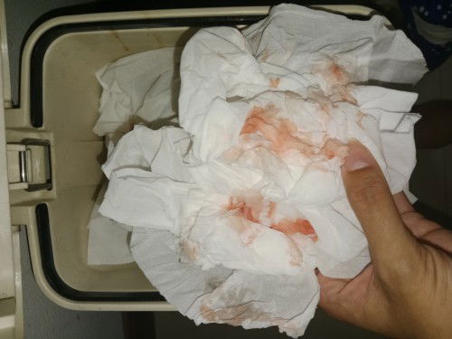 เลือดออกทางช่องคลอด